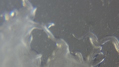 Panagrellus redivivus
