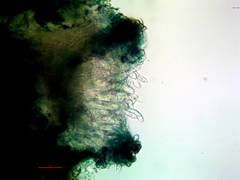 Cercidospora caudata