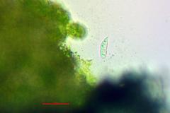 Cercidospora caudata
