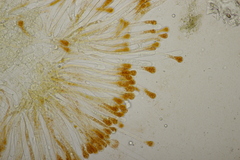 Cheilymenia granulata