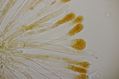 Cheilymenia granulata