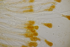 Cheilymenia granulata