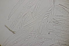 Cudoniella acicularis