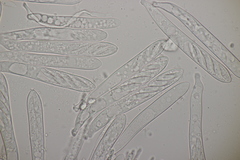 Cudoniella acicularis