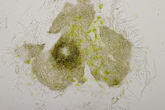 Septoria chelidonii