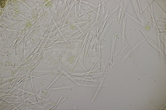 Septoria chelidonii