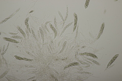 Lophiostoma vicinellum