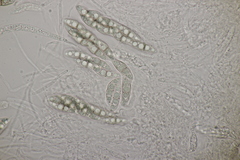 Lophiostoma vicinellum