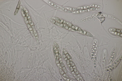 Lophiostoma vicinellum