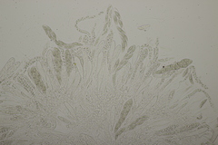 Lophiostoma vicinellum