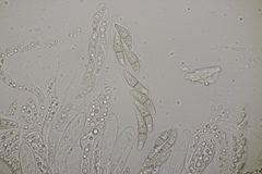 Lophiostoma vicinellum