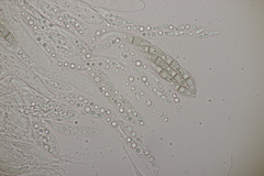 Lophiostoma vicinellum