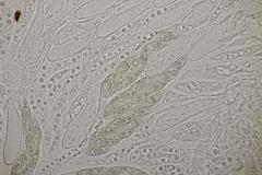 Lophiostoma vicinellum