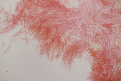 Mycoacia aurea