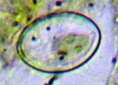 Cocconeis