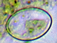 Cocconeis