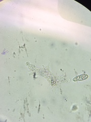 Amoeba