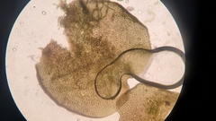 Marsupella emarginata