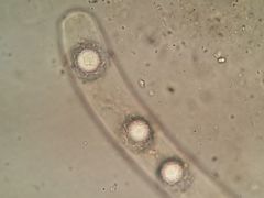 Lamprospora tortulae-ruralis
