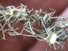 Usnea intermedia