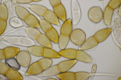 Puccinia kusanoi