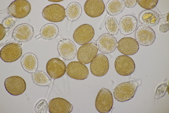 Puccinia obscura
