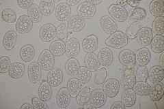 Milesina kriegeriana