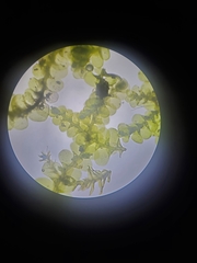 Cheilolejeunea clypeata