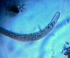 Spirostomum