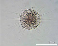 Actinosphaerium eichhornii