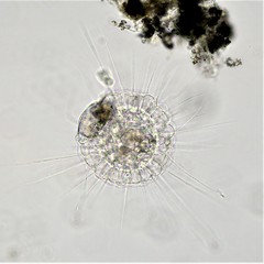 Actinosphaerium eichhornii