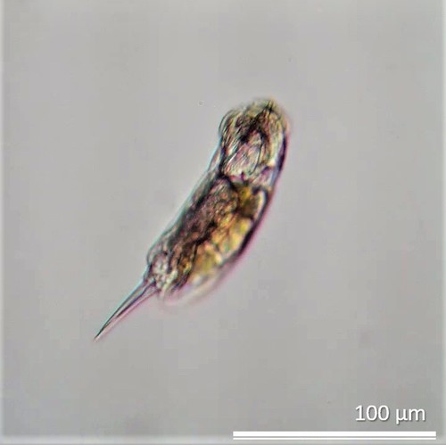 Cephalodella gibba