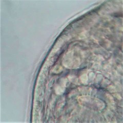 Stenostomum
