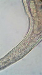 Stenostomum