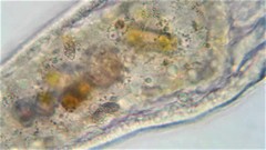 Stenostomum