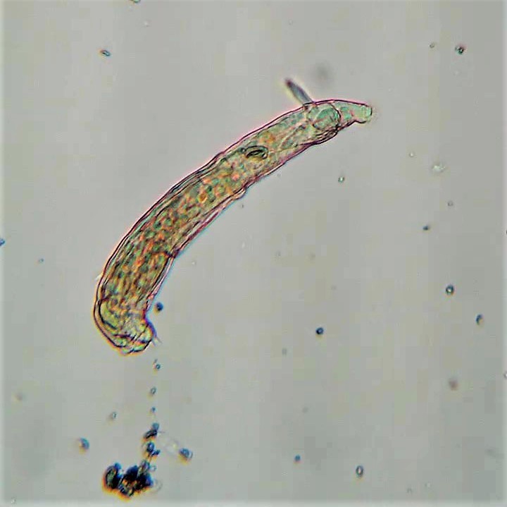 Habrotrocha collaris