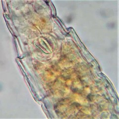 Habrotrocha collaris