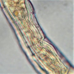 Habrotrocha collaris