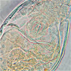 Habrotrocha collaris