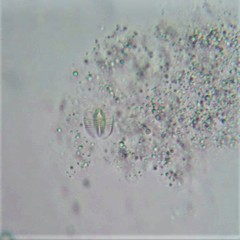 Habrotrocha collaris