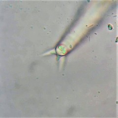 Philodina acuticornis odiosa