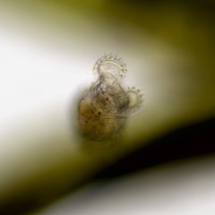 Philodina megalotrocha