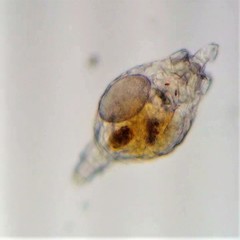 Philodina megalotrocha