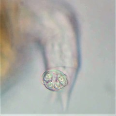 Philodina megalotrocha