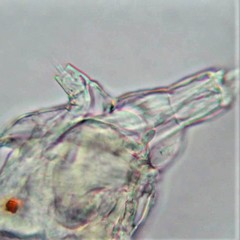 Philodina megalotrocha