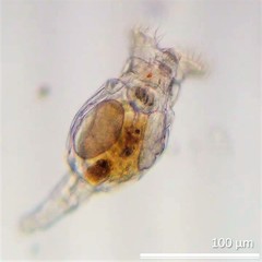 Philodina megalotrocha