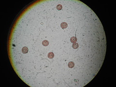 Diderma umbilicatum