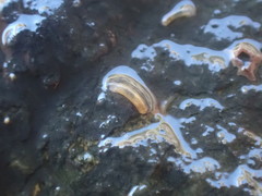 Caecum