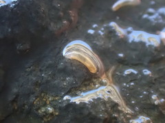 Caecum