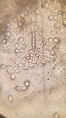 Penicillium digitatum